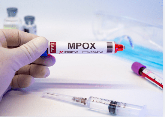 OMS convoca comitê para reavaliar emergência global por mpox